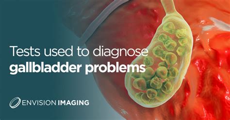 gallbladder x ray blood test